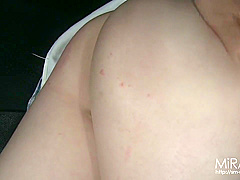 Miracle M Secacity For Immobility