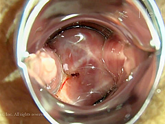 Net Linx n1476 Jav Uncensored Porn