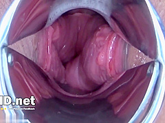 Fantastic Japanese Biotch Lets Us Inspect Her Slit - Best Asian Xxx!